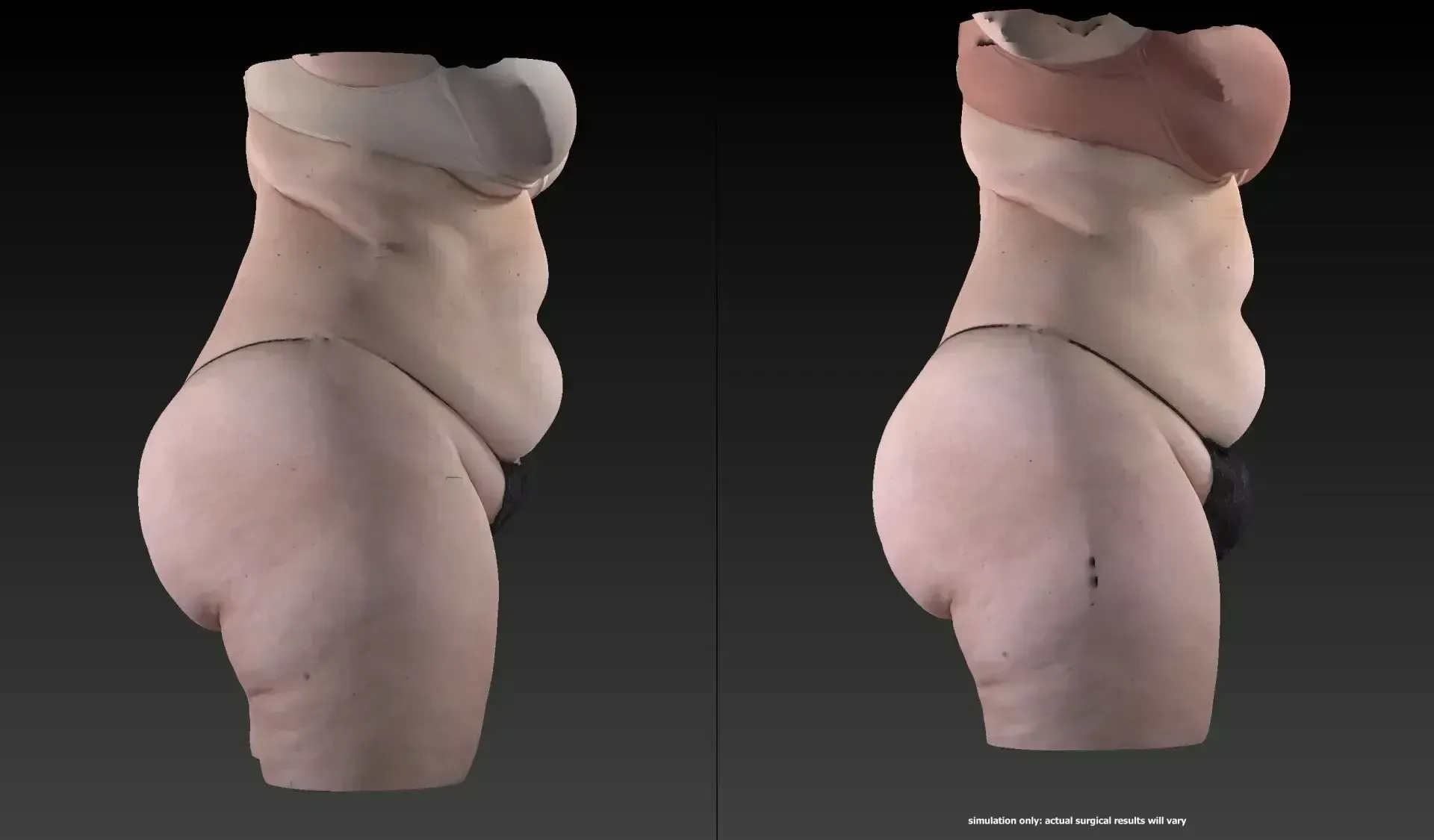 Two 3D scans of a person's torso from the side, one in beige, the other in brown, both with undergarments.