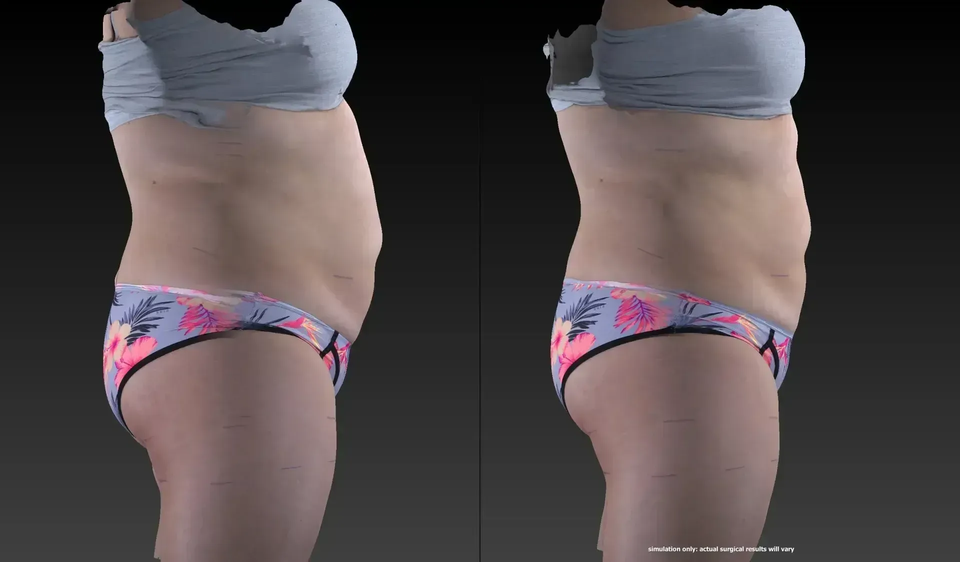 Two side-view body scans of a person wearing a bra and patterned underwear, showing before and after comparison of torso.
