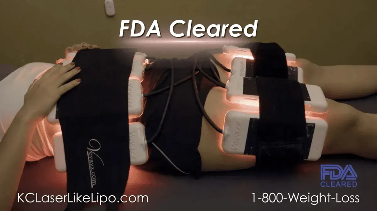 Person receiving a laser lipo treatment on their abdomen. FDA cleared. Light-emitting pads on the body.