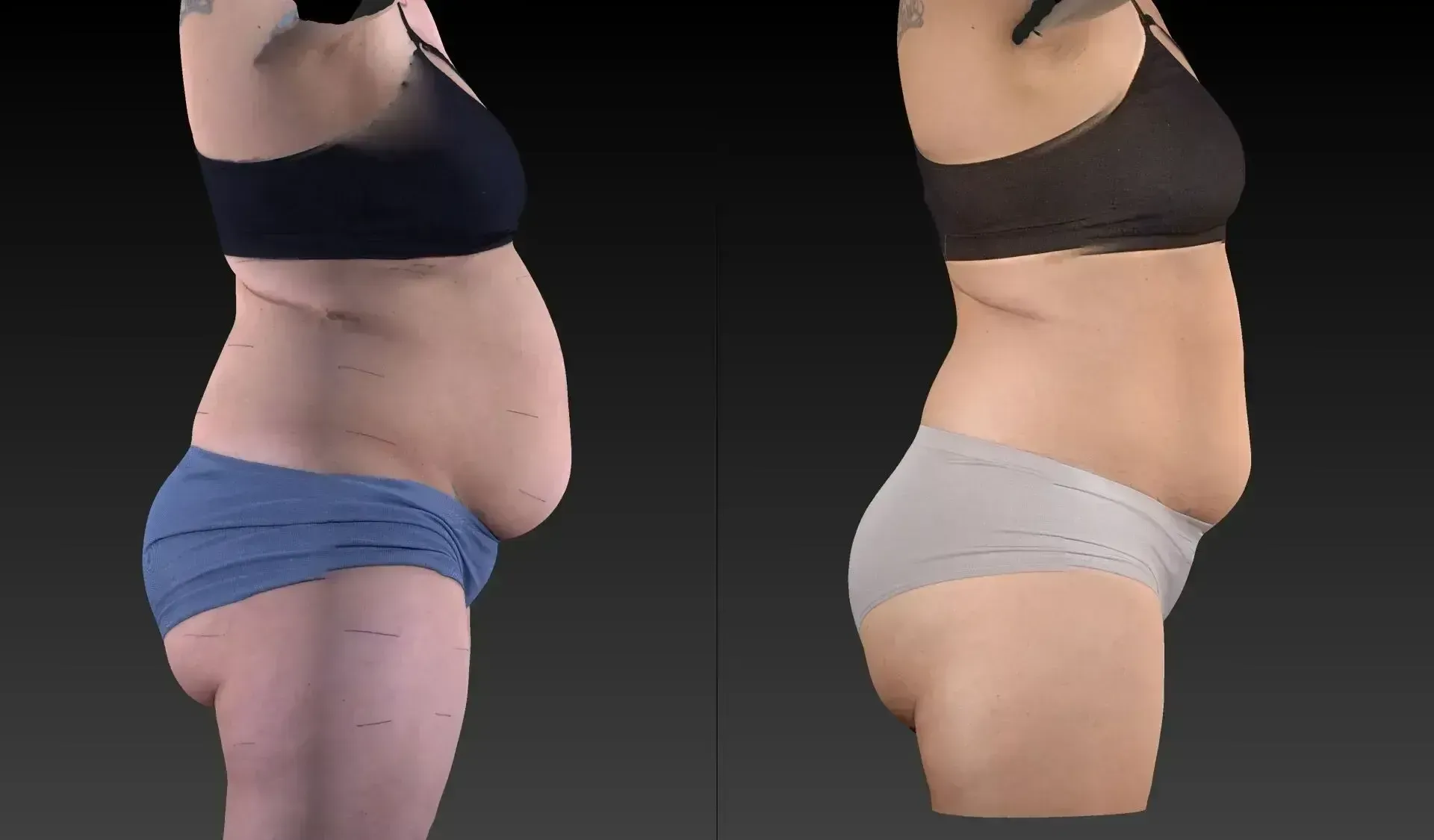 Two side-view body scans. Left shows blue shorts, right shows gray. Both have dark tops and visible abdominal fat.