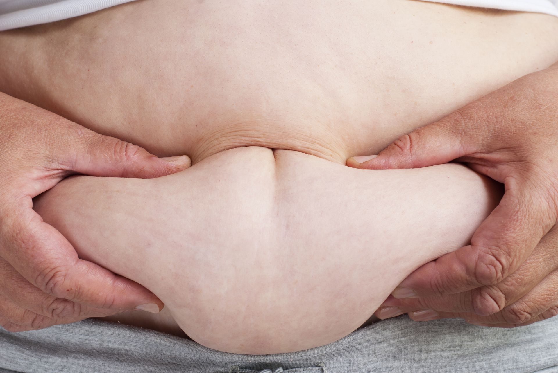 Hands pinch and hold belly fat, focused on skin folds.