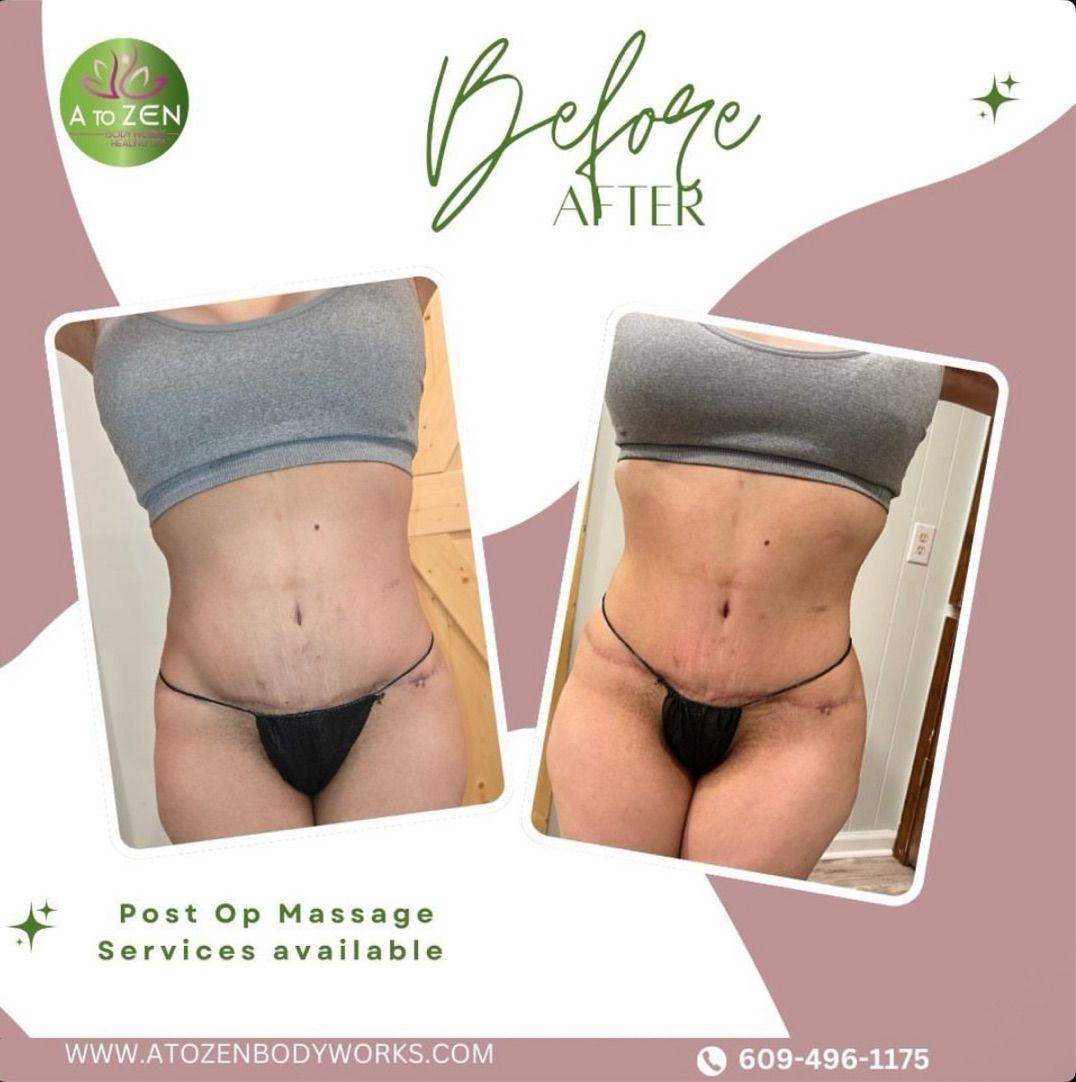 Before-and-after torso photo for a post-op massage service advertisement, with pink background and contact info.