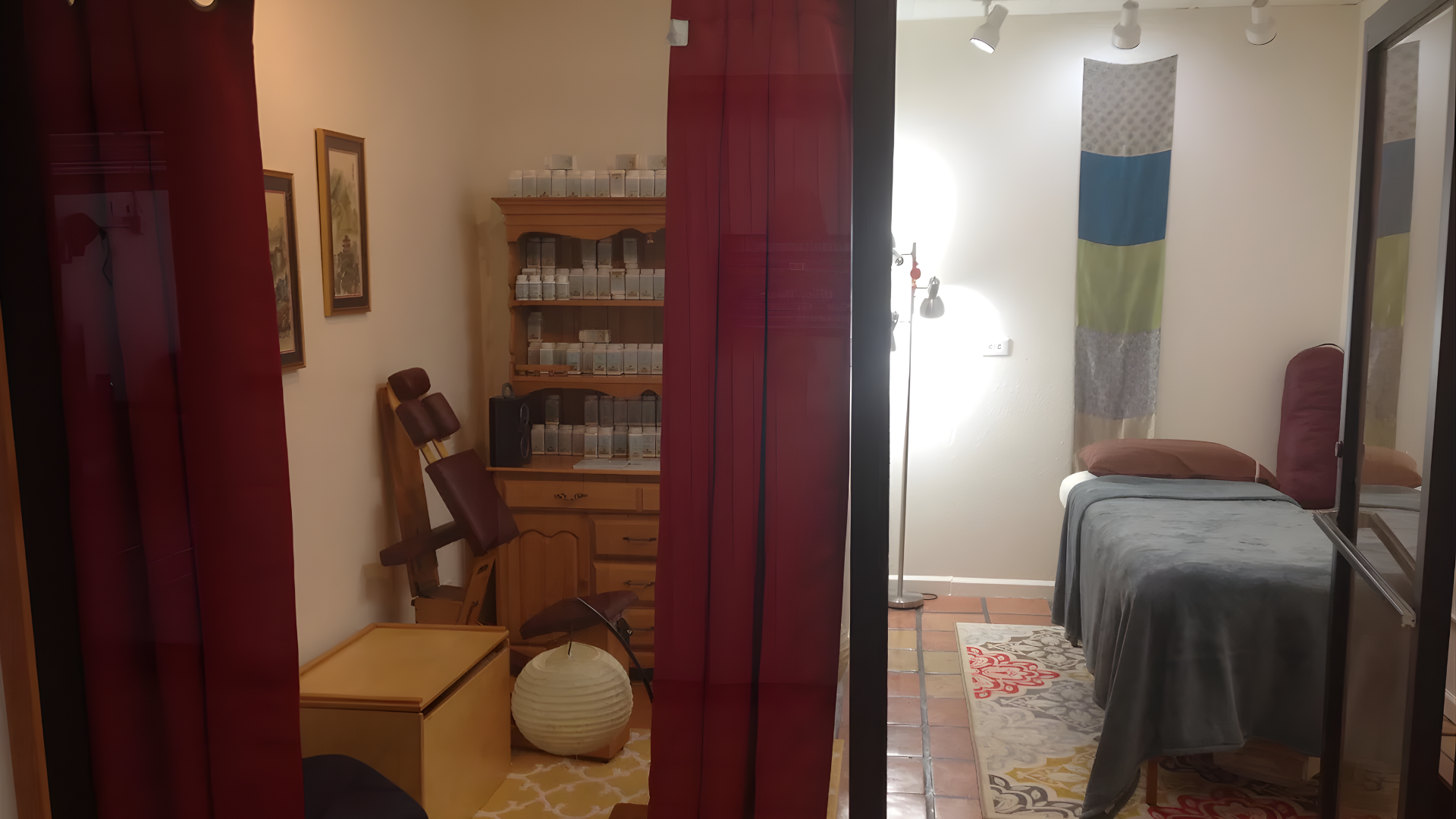 Person's shoulder with acupuncture needles inserted; close-up view near a window, natural light.