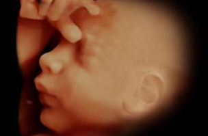 Fetal Vip Ortiz López y Cía. S. en C - TU BEBÉ Y TÚ EN LAS MEJORES MANOS