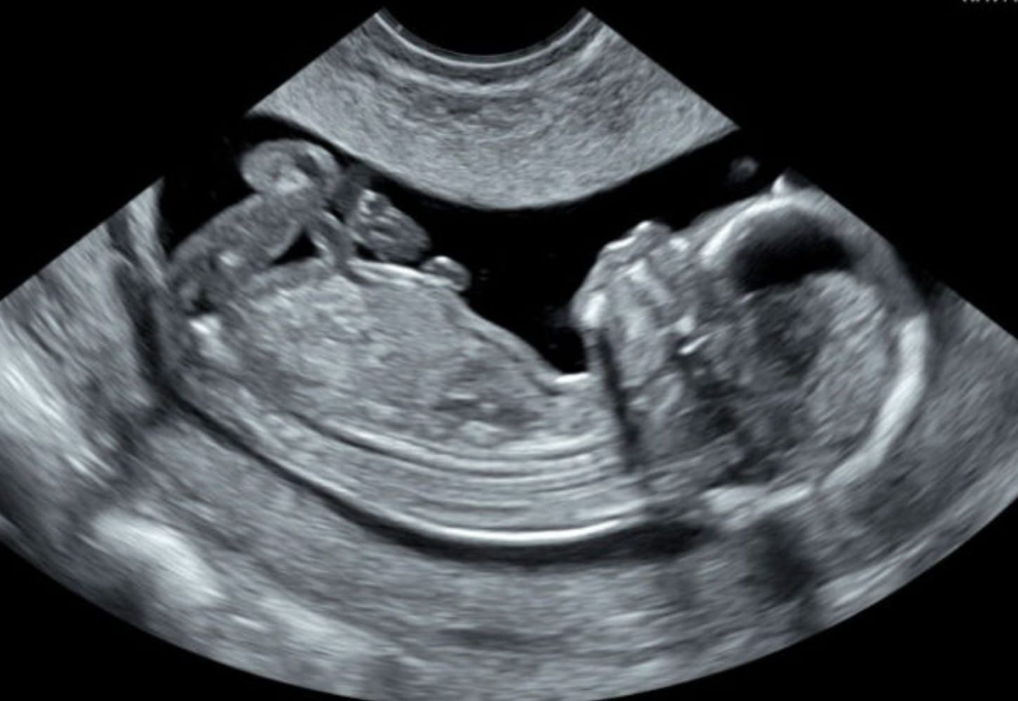 Fetal Vip Ortiz López y Cía. S. en C - TU BEBÉ Y TÚ EN LAS MEJORES MANOS