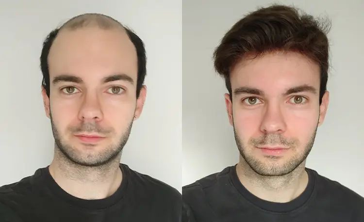 A before and after picture of a man with a wig on his head.