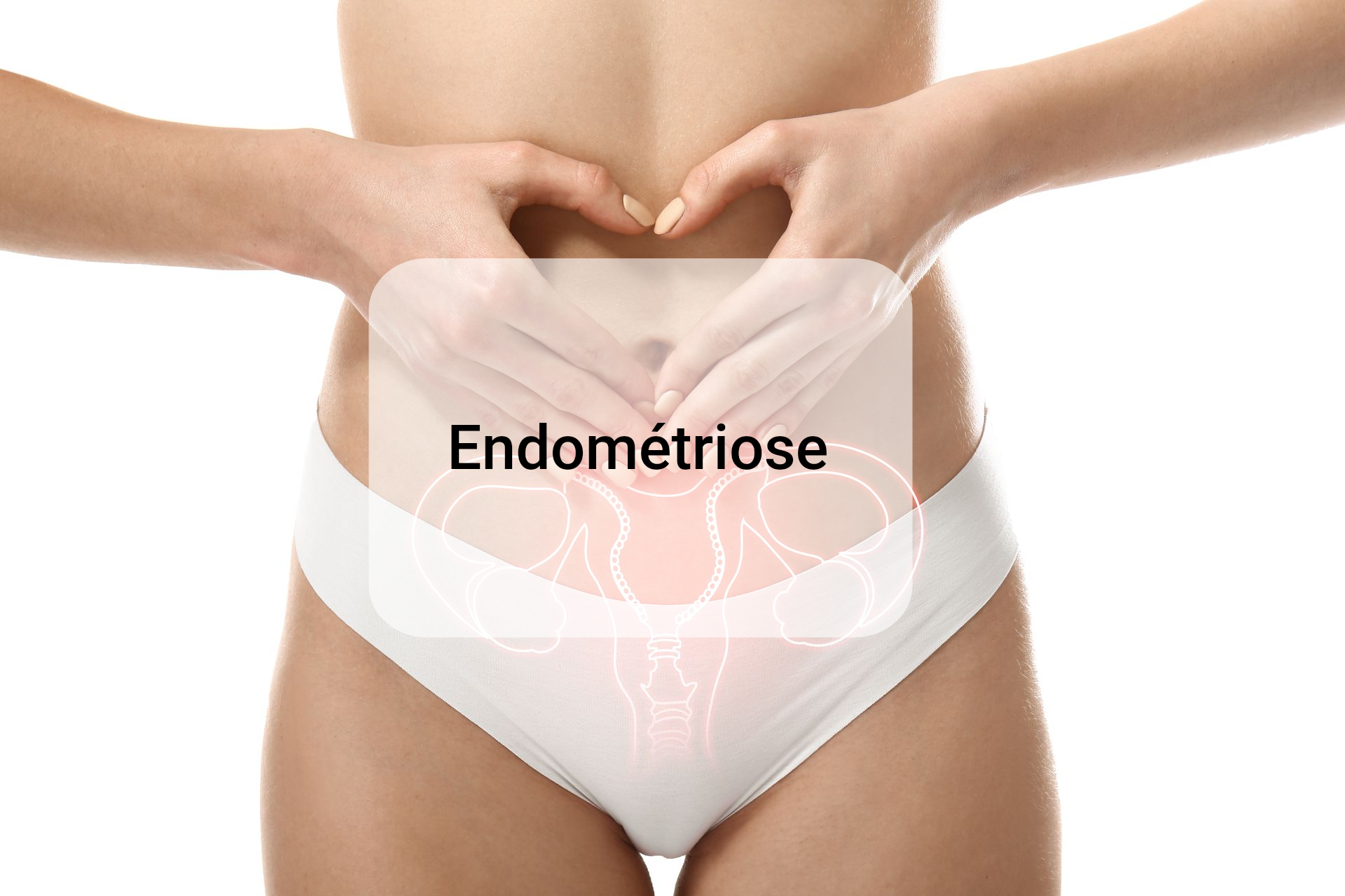 Endométriose endométriose femme