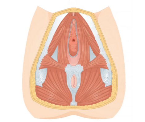 Rééducation périnéale et pelvienne