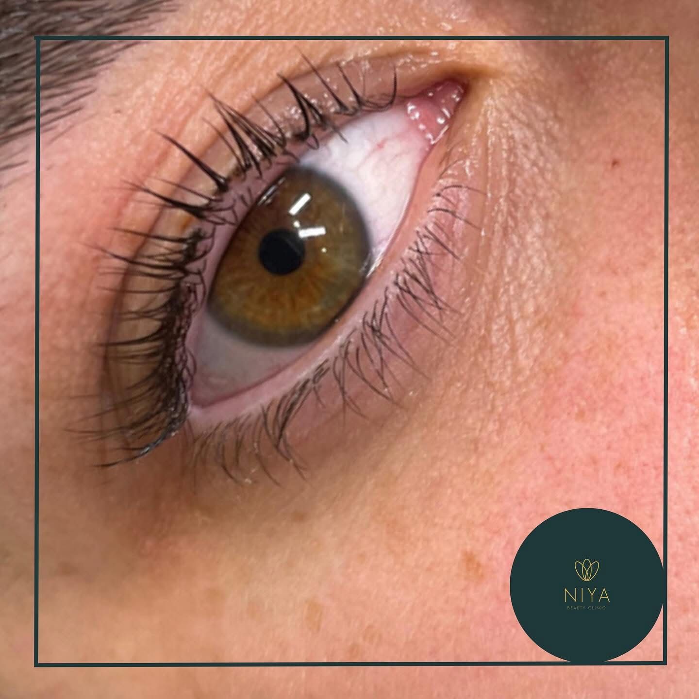 Close-up of a brown eye with long, dark lashes. The eye is slightly open, and the skin around it is visible.