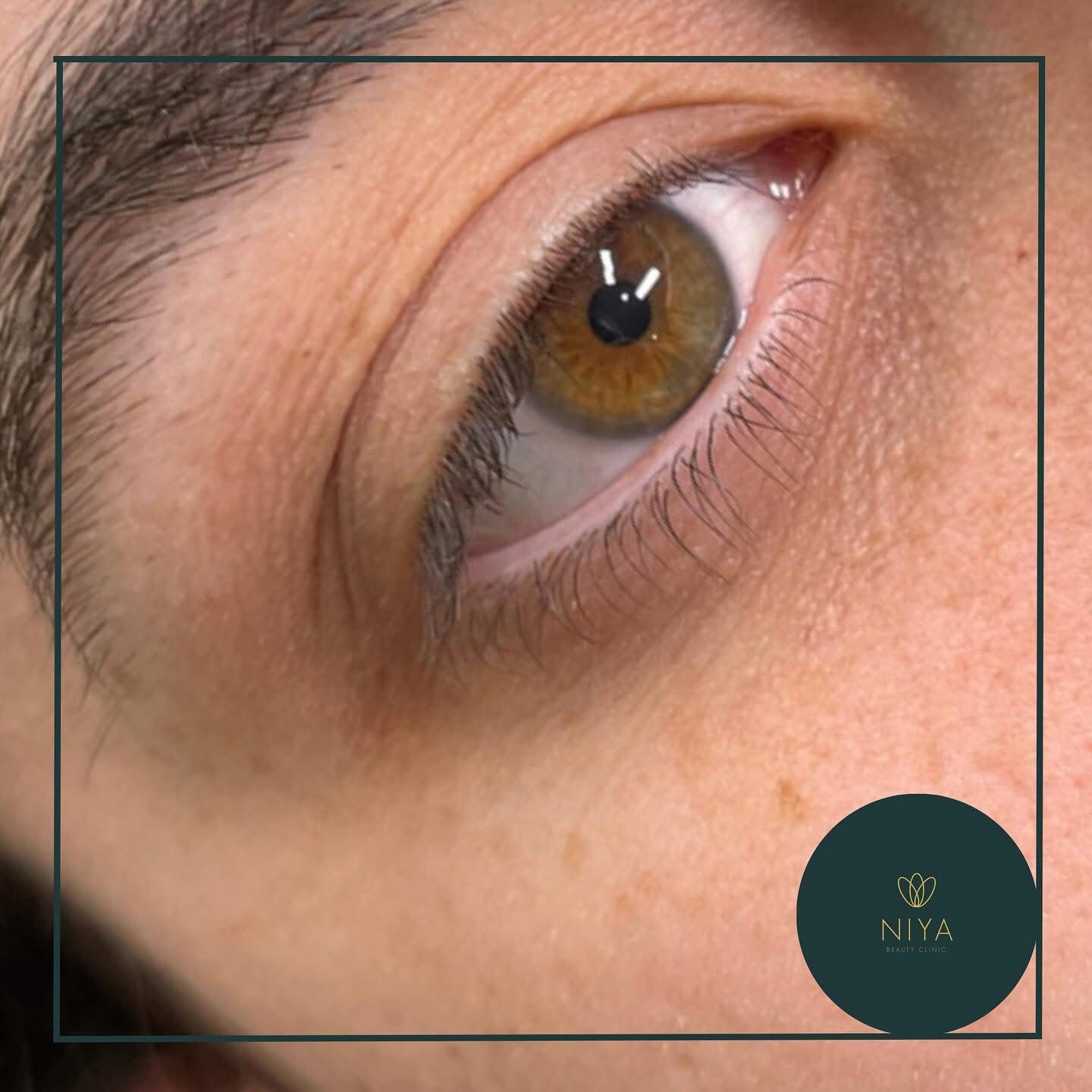 Close-up of a hazel eye with thin lashes; skin is tan, and a small dark-green circle logo is on the bottom right.