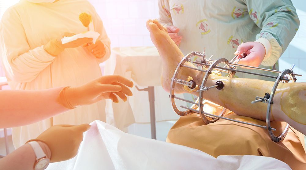 Reconstructive Surgery