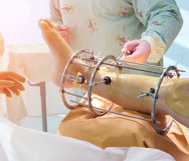 Reconstructive Surgery