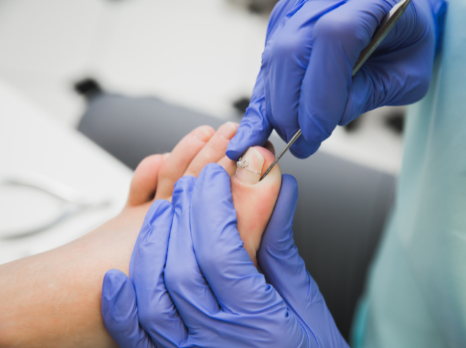 podiatrists singleton nsw