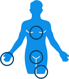 Cutaneous Venous Malformation Test