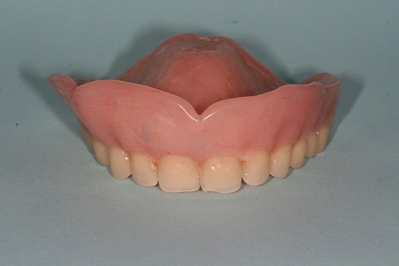 Dentures— San Diego, CA — Goldberg Dentistry