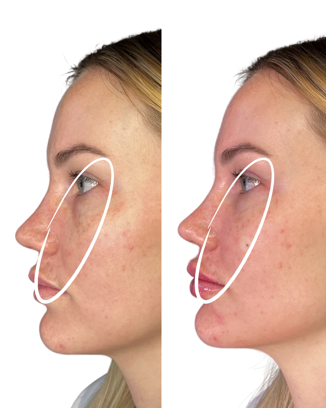 A before and after picture of a woman 's face