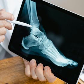 Persona che tiene in mano un tablet su cui è raffigurata una radiografia di un piede, indicando con uno stilo.