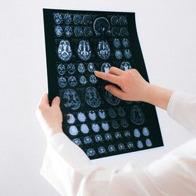 Mani che tengono e indicano una radiografia del cervello
