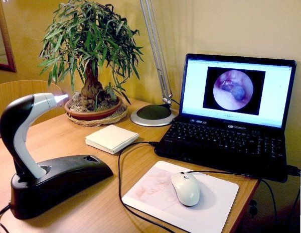 computer portatile con risultati otofibroscopia