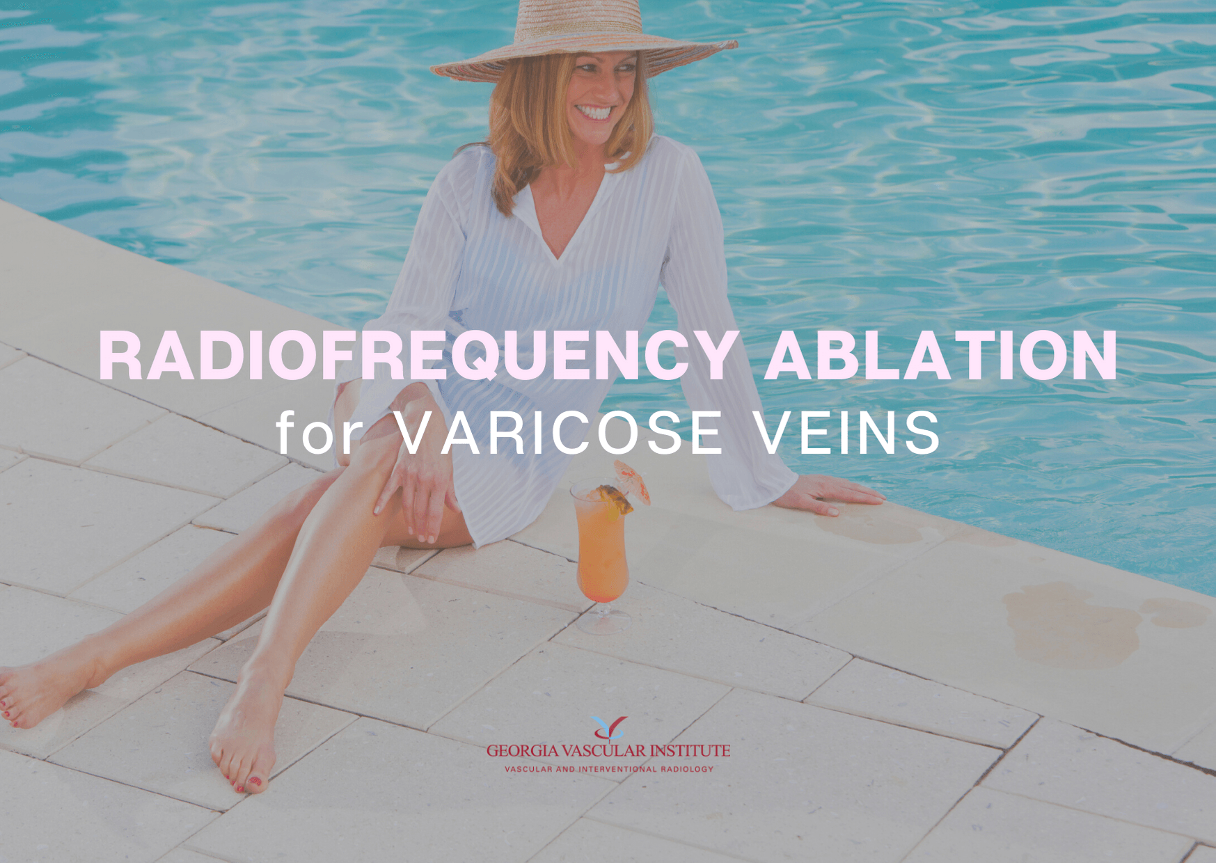 Radiofrequency Ablation For Varicose Veins