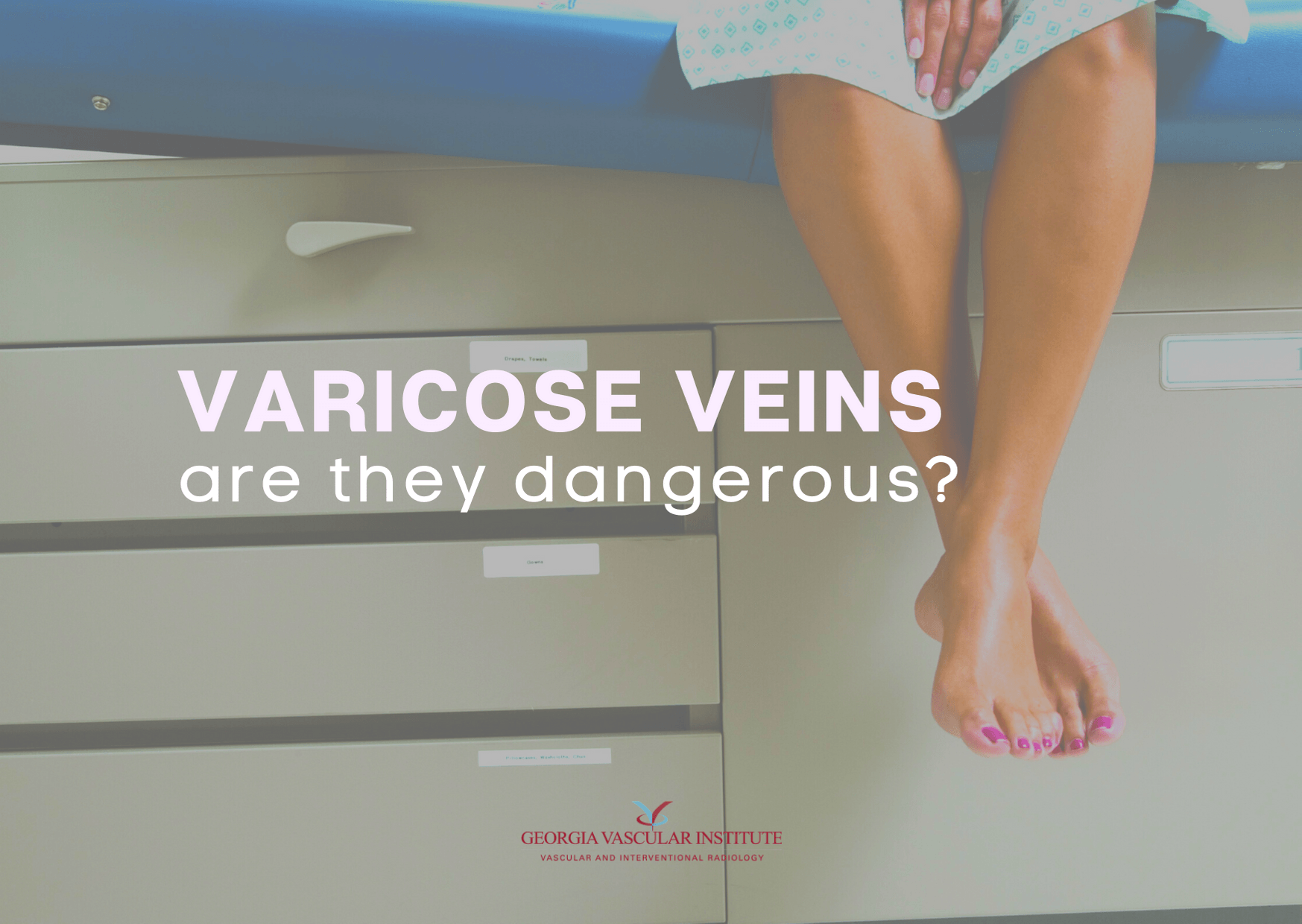 the danger of varicose veins