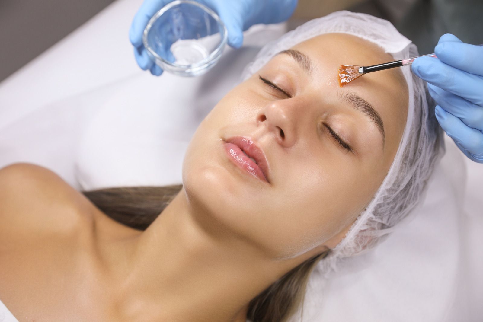 Person receiving a facial peel treatment. A gloved hand applies a liquid from a brush to the forehead.