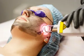 Person receiving a facial peel treatment. A gloved hand applies a liquid from a brush to the forehead.