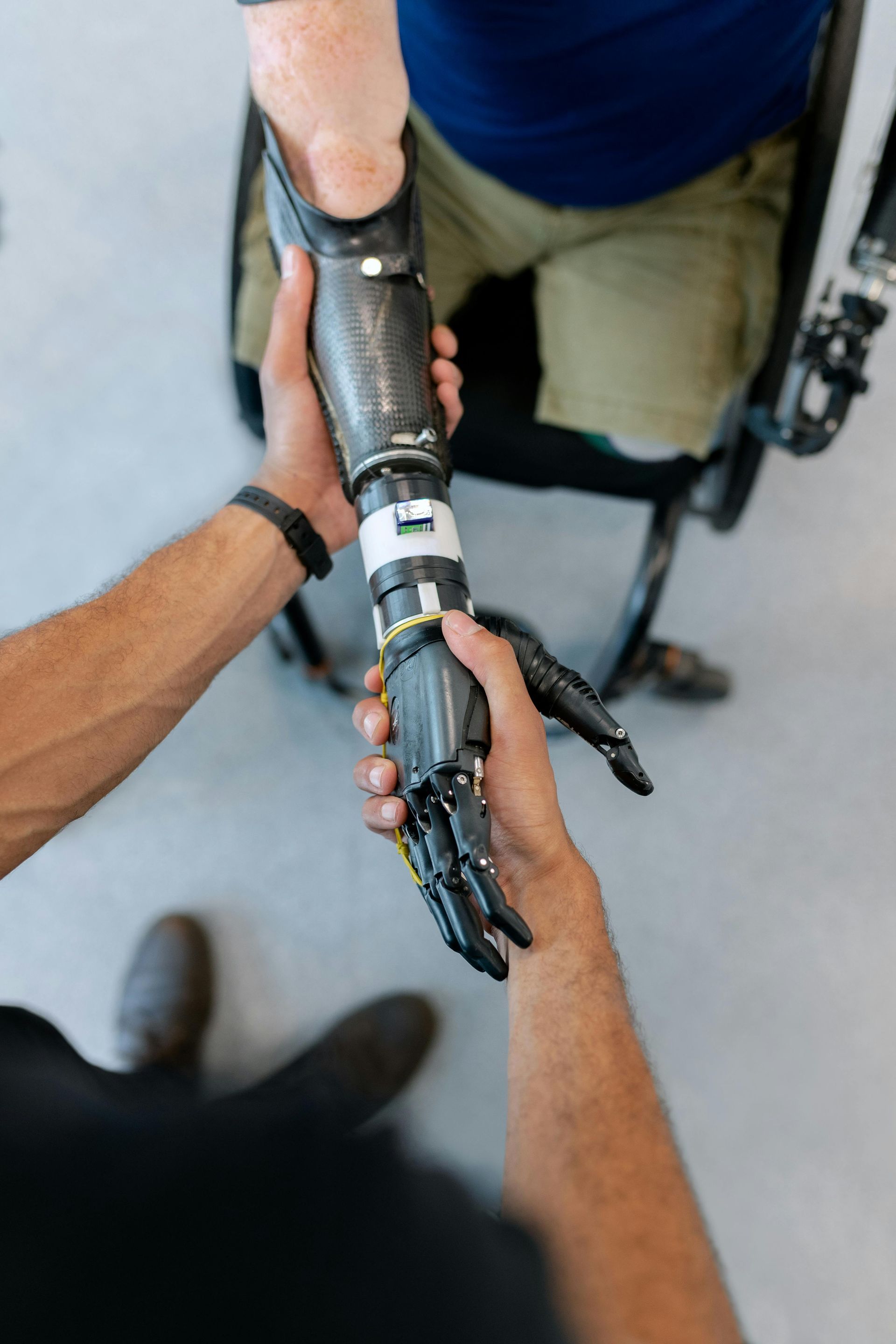 human-hand-holding-artificial-limb