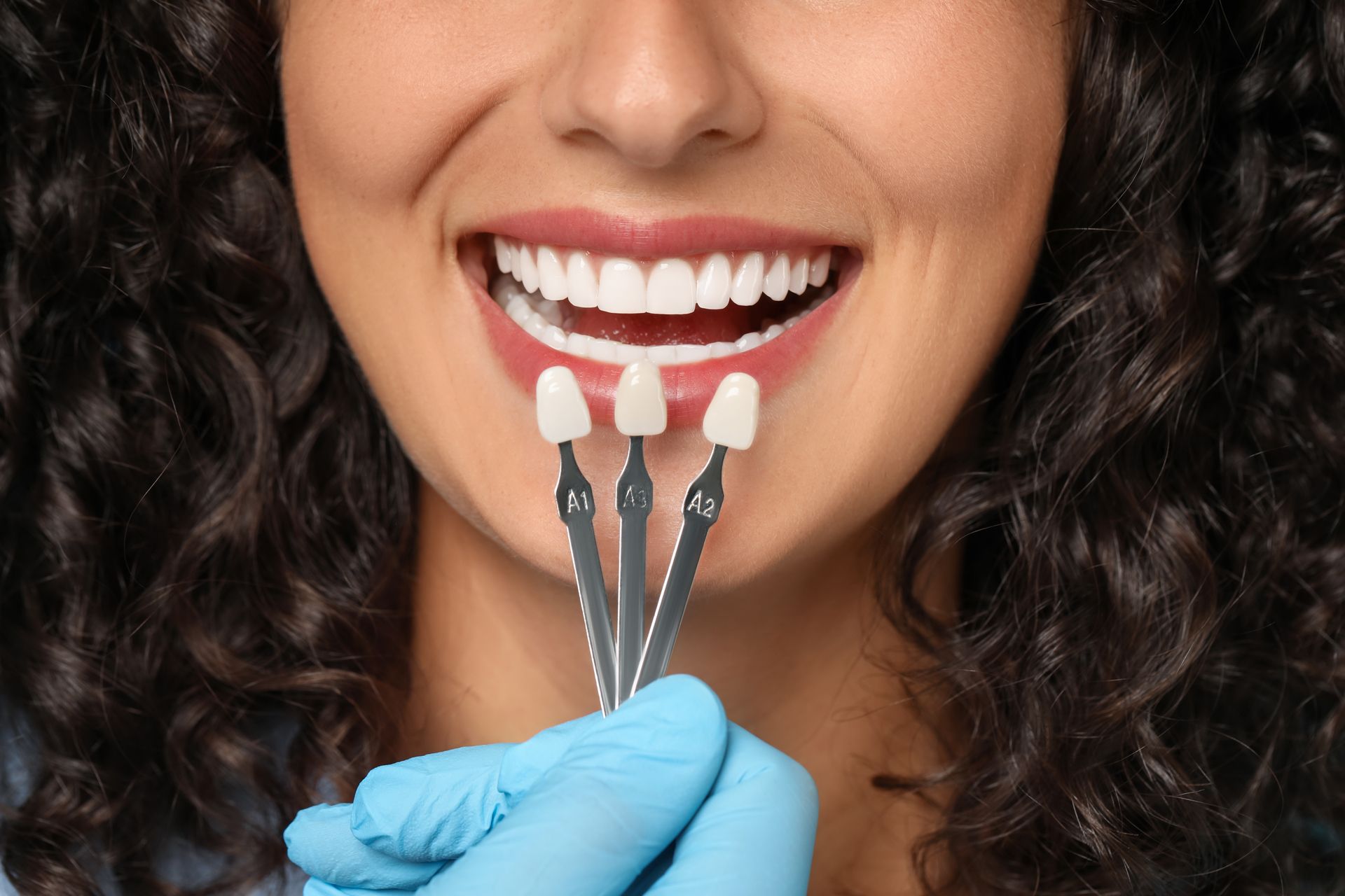 Gloved hand holding shade tabs beside smiling mouth with white teeth, selecting tooth color shade