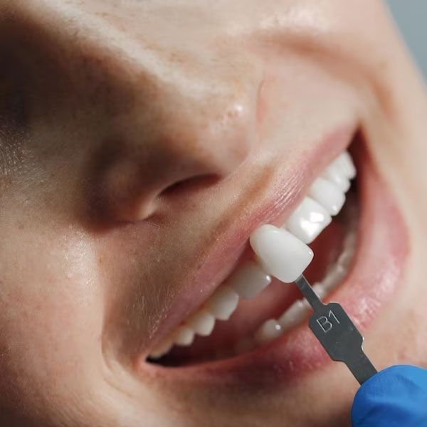 Woman smiling with dental crown held up to a tooth | Makeover your smile with dental crowns and bridges at our affordable Houston TX 77042 dentist