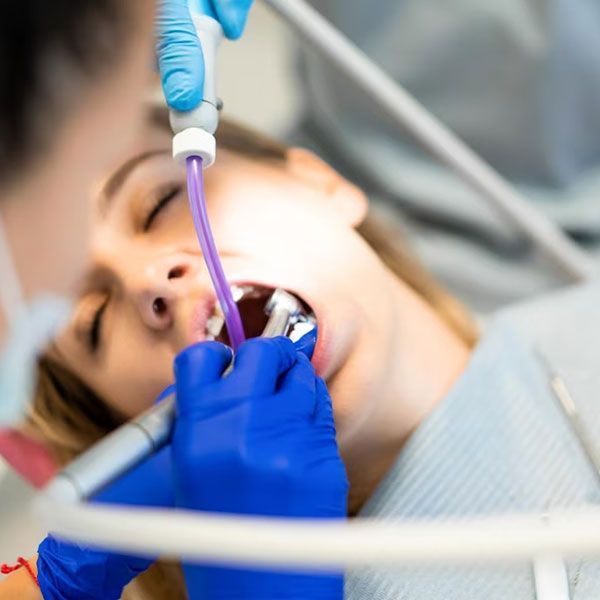 Dental Client With Mouth Open | Sinus Lifts & Ridge Augmentations | Dental Implants Houston TX 77042