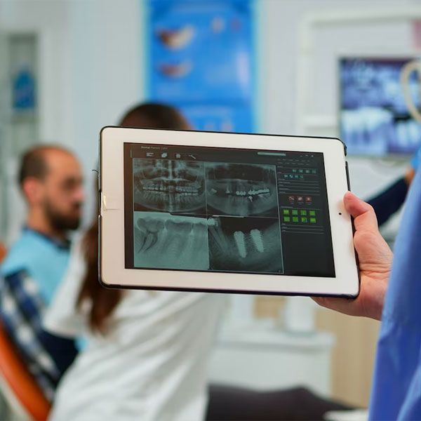 digital xray on iPad | Modern Technology | Best Dentist in Houston TX 77042