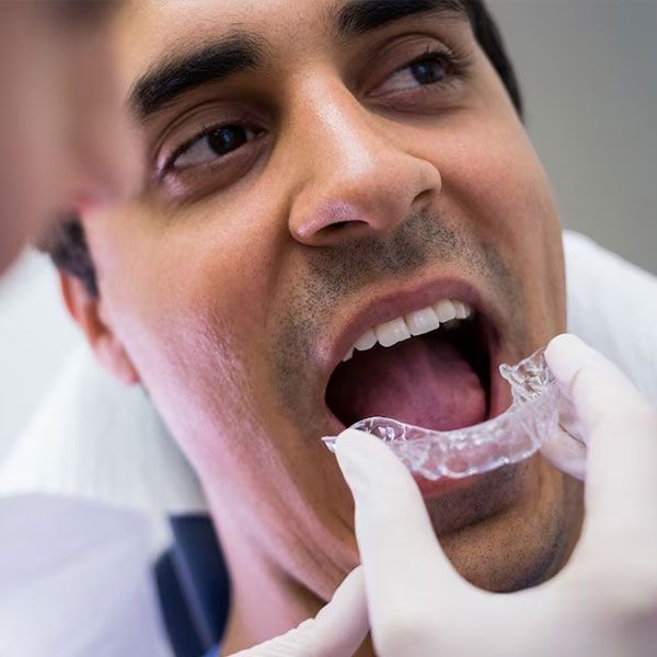 male patient putting on mouth guard | Fix teeth grinding with oral appliances and night guards | Dentist near Houston 77042