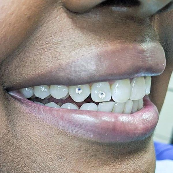 Person smiling with tooth gems | Get dental tooth gems in Houston TX 77042