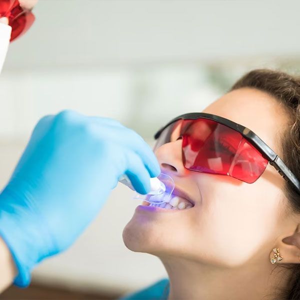 woman having teeth whitening through UV | cosmetic dentist in Houston TX 77042