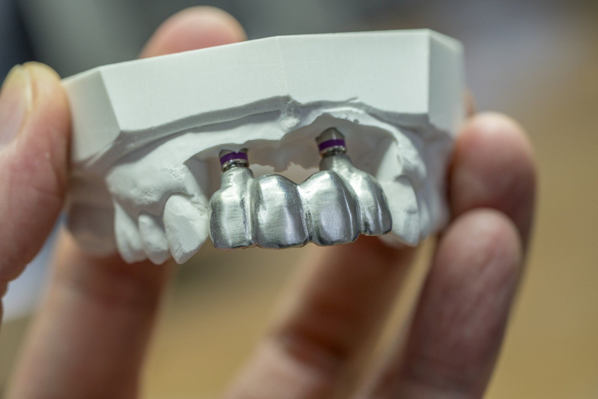 Dental Implants — Maryville, TN — Blount Laser Dentistry