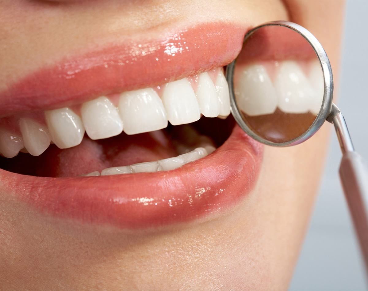 Close-up Of A Person's Bright White Teeth, With A Dental Mirror Reflecting The Upper Teeth And Pink, Glossy Lips