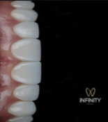 Primer plano de una hilera de dientes blancos, brillantes e impecables, con el logotipo 