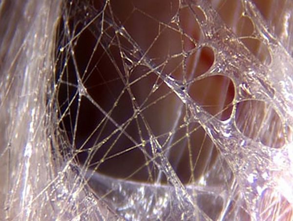 Oppervlakkig bindweefsel (Fascia)