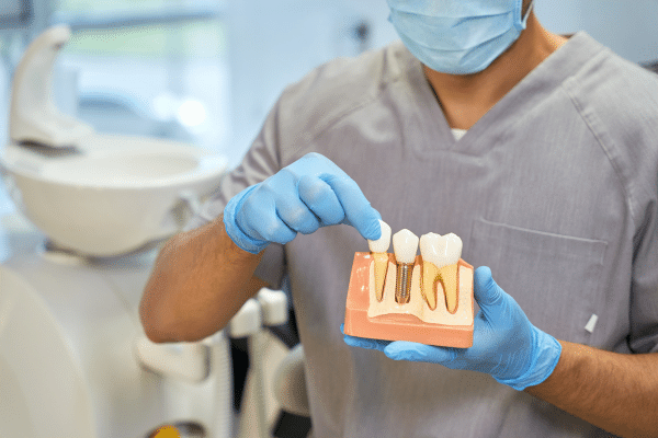 A dentist is holding a model of teeth in his hands.