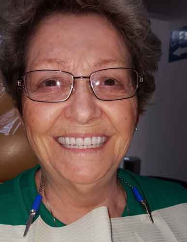 Happy Woman 27 — Kennebunk, ME — Denture Solutions