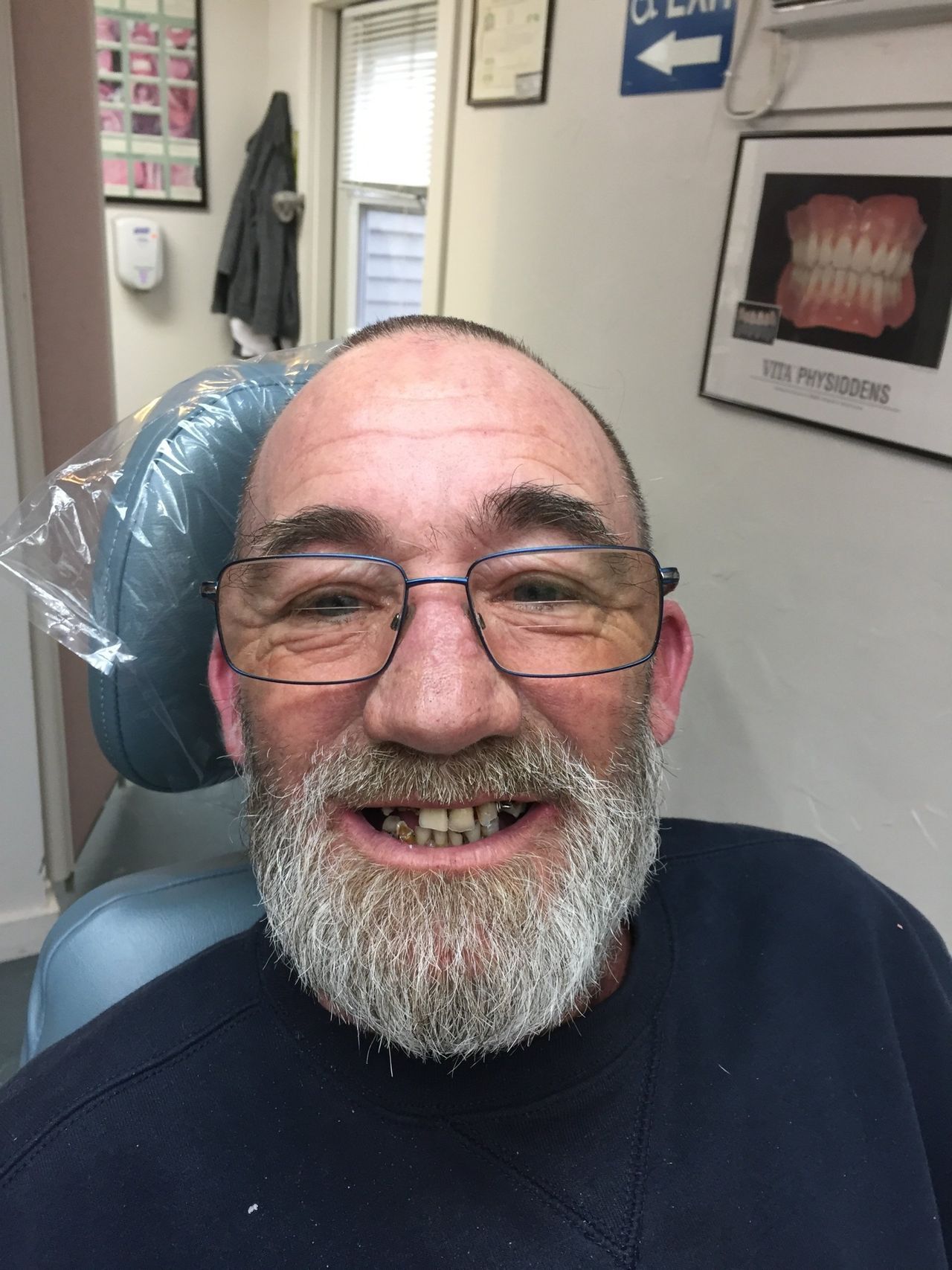 Before Old Man— Kennebunk, ME — Denture Solutions