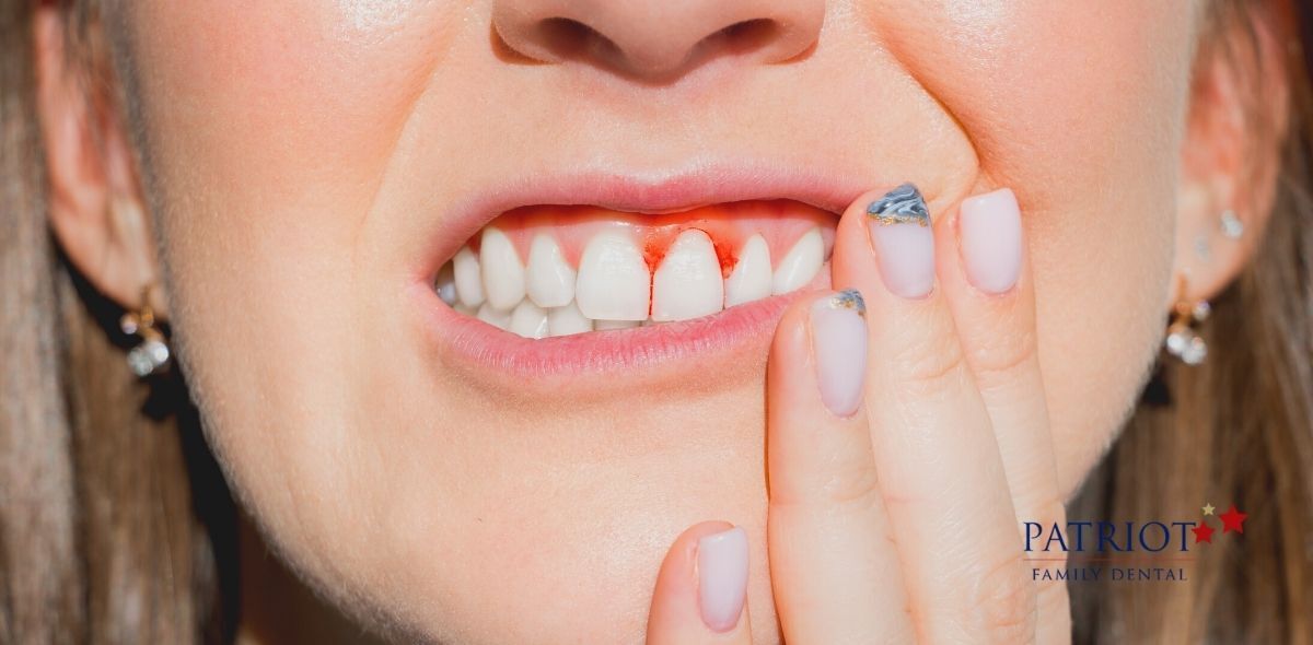 woman with bleeding gums - symptom of gum disease