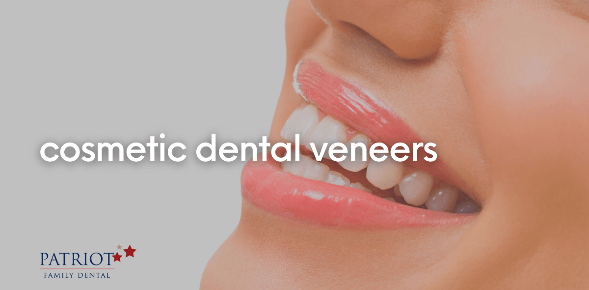 Cosmetic dental veneers graphic