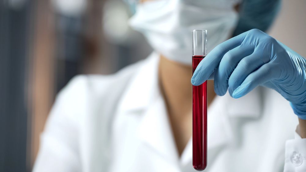 Una persona con bata blanca de laboratorio y guantes azules sostiene un tubo de ensayo de vidrio que contiene un líquido rojo.