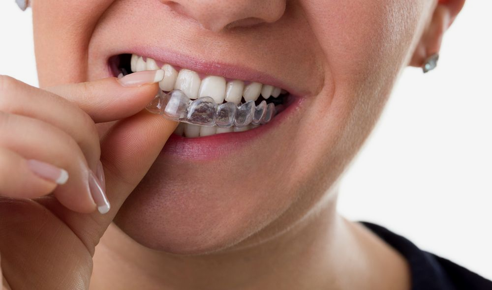 A woman is smiling while sitting in a dental chair.