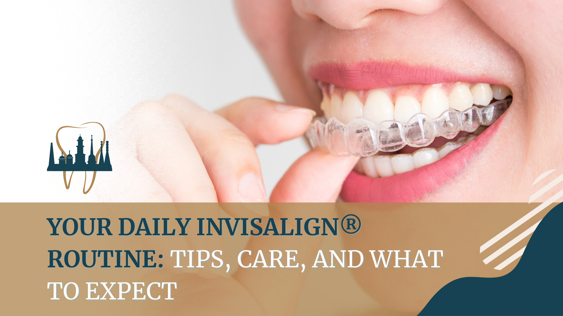 A woman is wearing a clear retainer on her teeth.