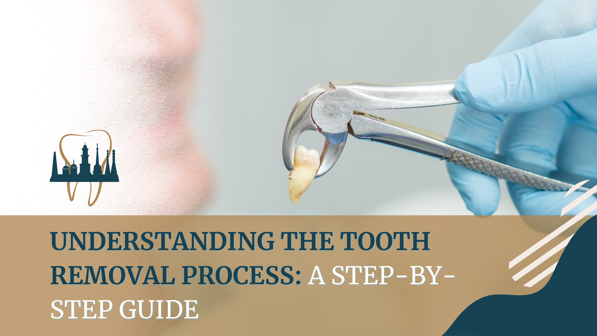 A step by step guide to understanding the tooth removal process