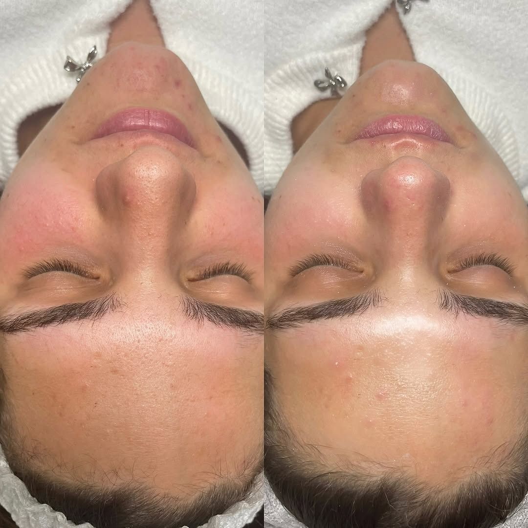 Una foto del prima e del dopo del viso di una donna con gli occhi chiusi.