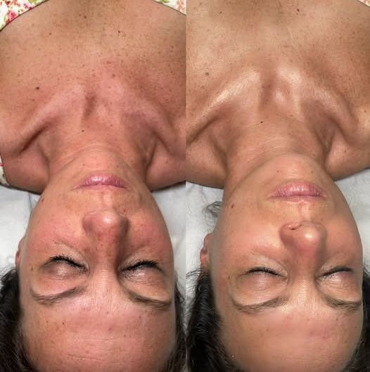 Una donna è sdraiata sulla schiena con gli occhi chiusi.